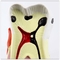 Caries Comparison Dental Teeth Model / Dental Demonstration Models For Teaching