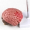 Pathologies Medical Brain Human Anatomical Model