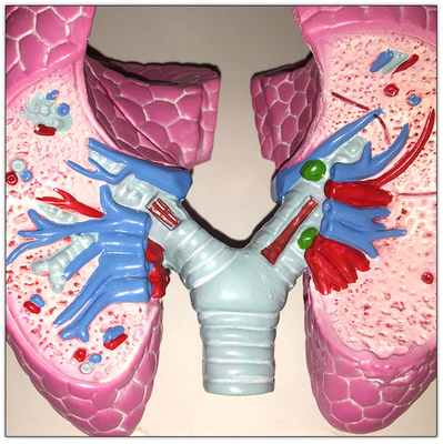 Nhựa COPD Phổi Cơ thể người Cơ quan Mô hình học tập nội tạng 19x13x17cm